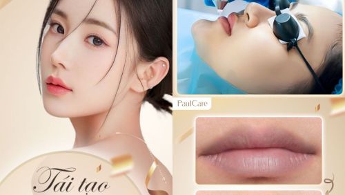 Nguyên nhân gây thâm môi và các cách thức điều trị thâm