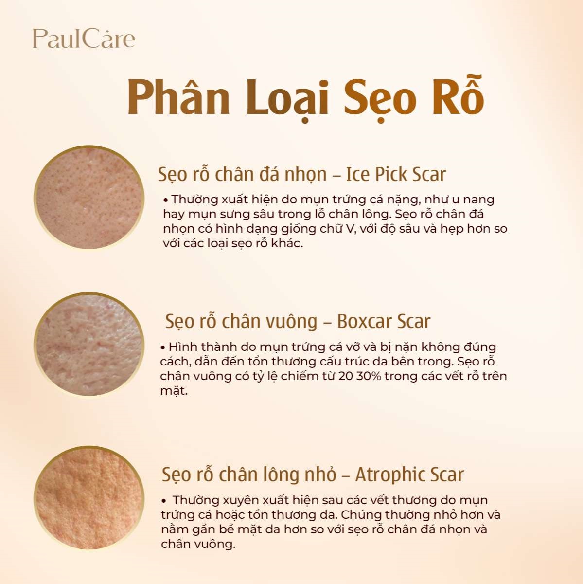 phan_loai_seo_ro_paulcare