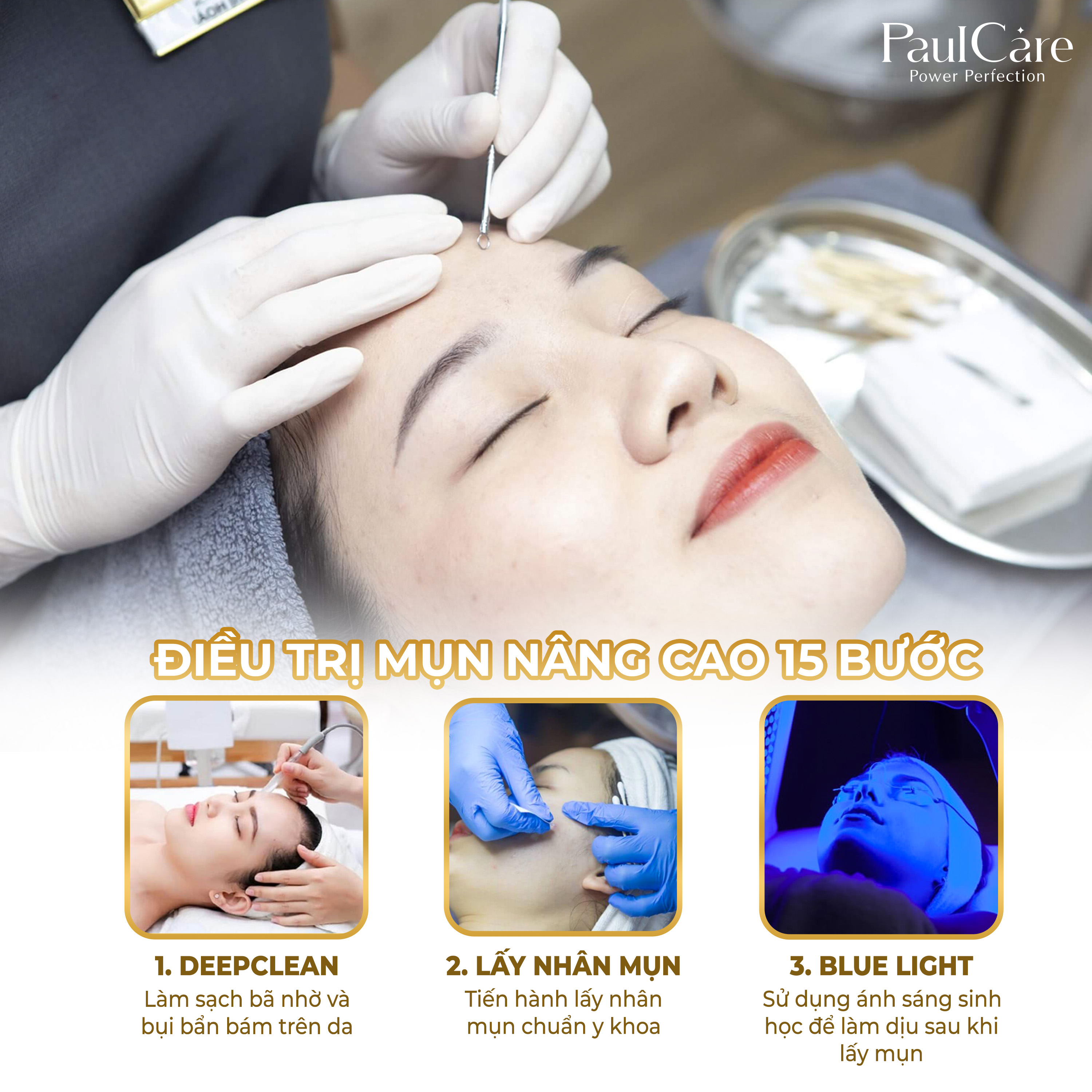 15_buoc_lay_nhan_mun_chuan_y_khoa_PaulCare