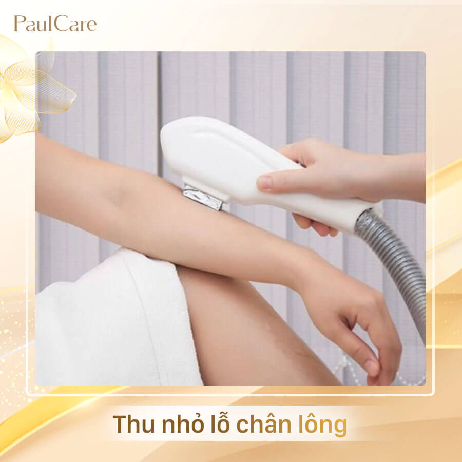 triet_long_vinh_vien_tham_my_vien_paulcare (3)